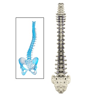 Posterior Scoliosis Surgery