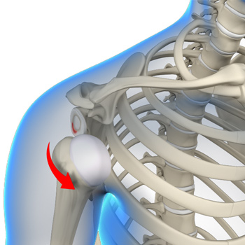 Anterior Shoulder Instability