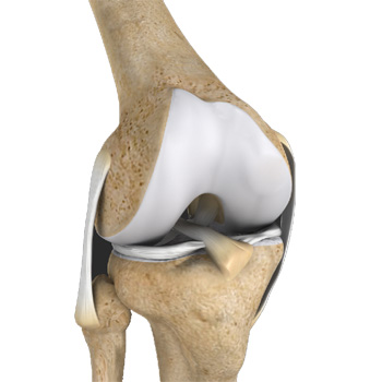 Multiligament Instability