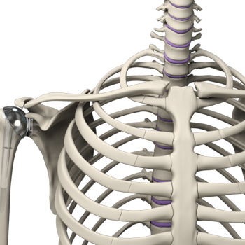 Outpatient Shoulder Replacement
