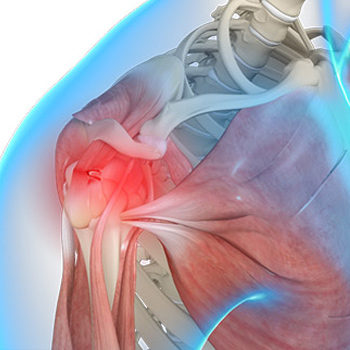 Shoulder Trauma