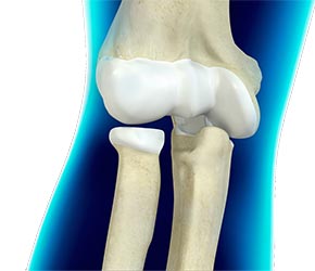 Elbow Anatomy - Educational Picture
