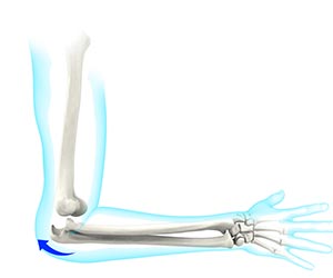 Elbow Instability - Educational Picture