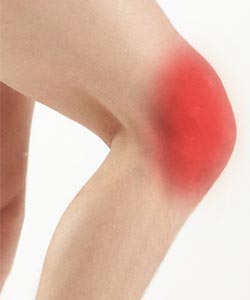 Knee Pain