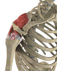 Partial Rotator Cuff Tear - Educational Picture