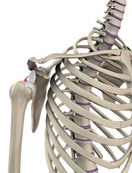 Shoulder Dislocation - Educational Picture