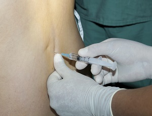 In-Office Lumbar Injections