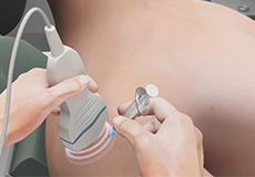 Ultrasound Guided Injections