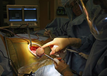 Dr. Robert Gorab removes the ball of the femur from Jane Glenn logo