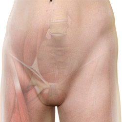Hip Disorders