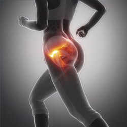 Hip Injuries