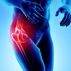Hip Pain