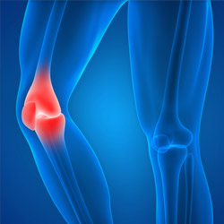 Knee Injury