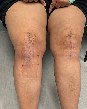 Ms. D. Z testimonial