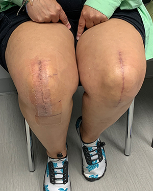 Ms. D. Z testimonial