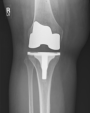 Ms. D. Z testimonial