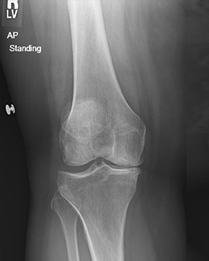 Ms. D. Z testimonial