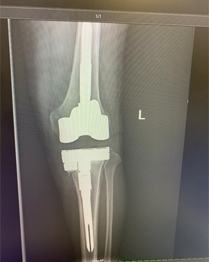 Ms. D. Z testimonial