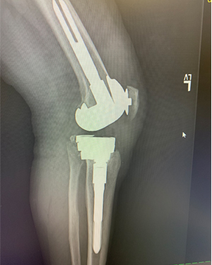 Ms. D. Z testimonial