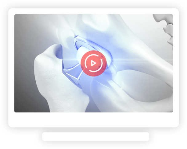 Patient Education Videos