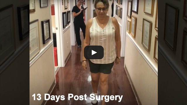knee-replacement-surgery