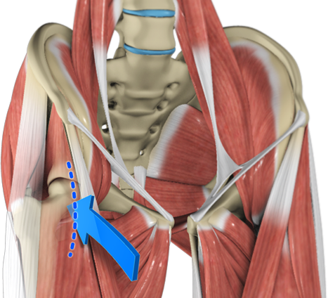Direct Anterior Hip Replacement