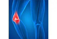 Knee Injury