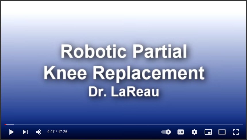 Robotic Partial Knee Replacement