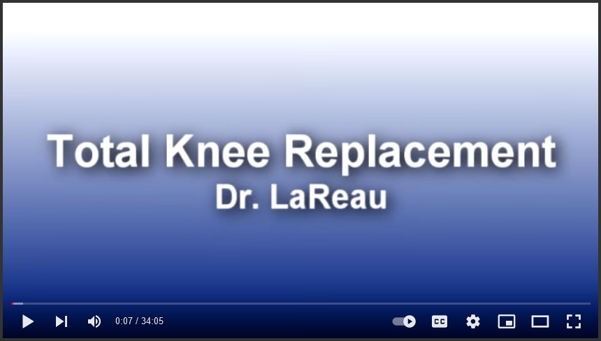 Total Knee Replacement