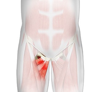 Athletic Pubalgia