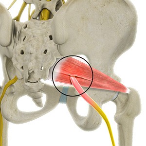 Deep Gluteal Pain Syndrome