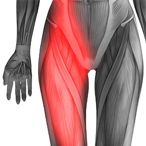 Hip Flexor Pain