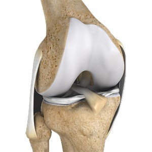 Multiligament Instability