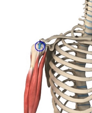 Long Head Biceps Tendon Rupture