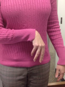 Dr. Atul Patel Discusses Treatments For Spasticity 01