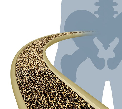 Bone Health and the Importance of Vitamin D 02