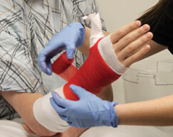 Casting a Broken Wrist- On the Vine