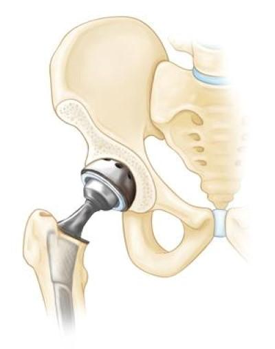 Hip Resource4