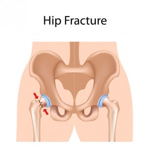 Arthritis- There is so many different kinds 04