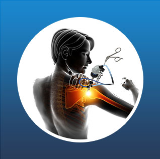 Arthroscopic Surgery