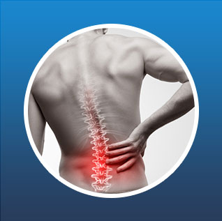 Non-operative Spine Management