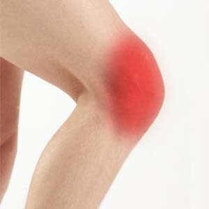 Anterior Knee Pain