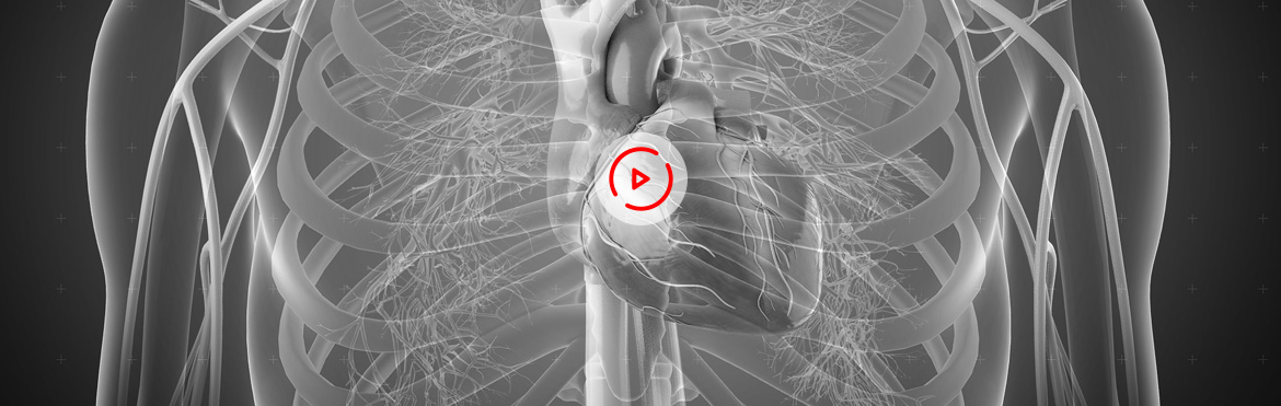 Patient Education video