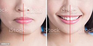 Maxillofacial Surgery