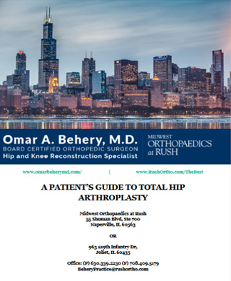 Patient Guide to Hip Arthroplasty