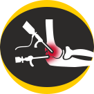Elbow Arthroscopy New