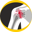 Periprosthetic Infection