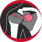 Rotator Cuff Tendinitis