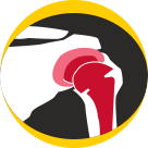 Shoulder Joint Replacement New