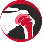 Shoulder Joint Replacement